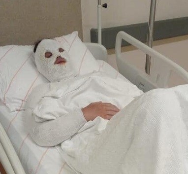 Eski nişanlısına kimyasal sıvı atan kişiye 15 yıl hapis