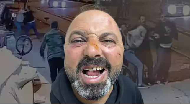 Baba ve oğula dayak! Sebebi: Ne bakıyorsun!
