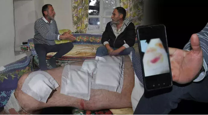 500 kiloluk ayıdan mucize kurtuluş
