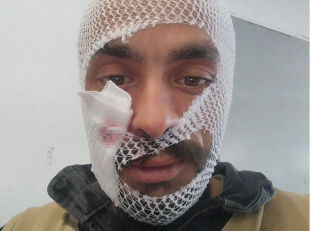İneğinin boynuz darbeleri ile yaralanan gencin paylaşımı gülümsetti