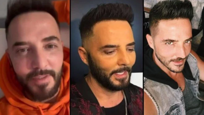 Gökhan Özen’den estetik iddialarına yalanlama