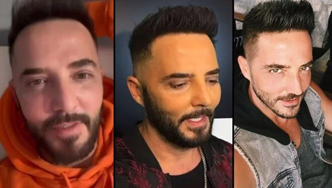 Gökhan Özen’den estetik iddialarına yalanlama