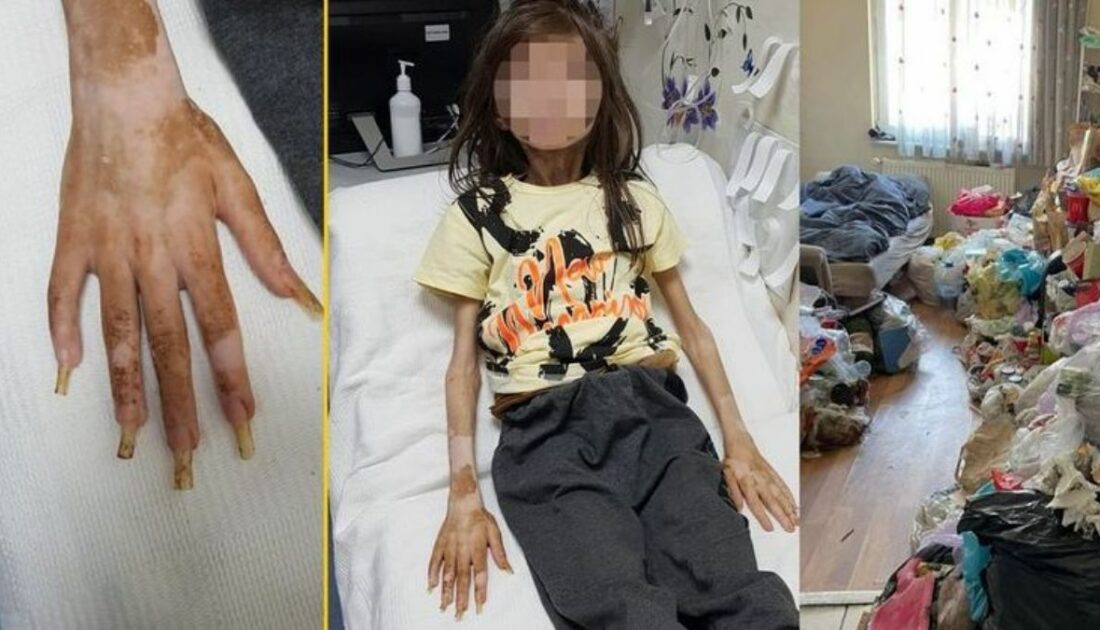 Bursa’da çöp ev skandalı! Teyze ile ilgili karar çıktı