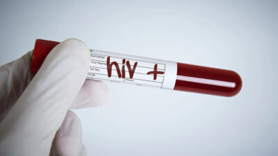 Türkiye’de HIV artış eğiliminde: Gizli pandemi gibi!