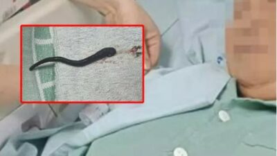 Aralıksız olarak burnu kanayan kadın doktorları da şaşırttı!
