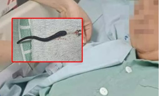 Aralıksız olarak burnu kanayan kadın doktorları da şaşırttı!