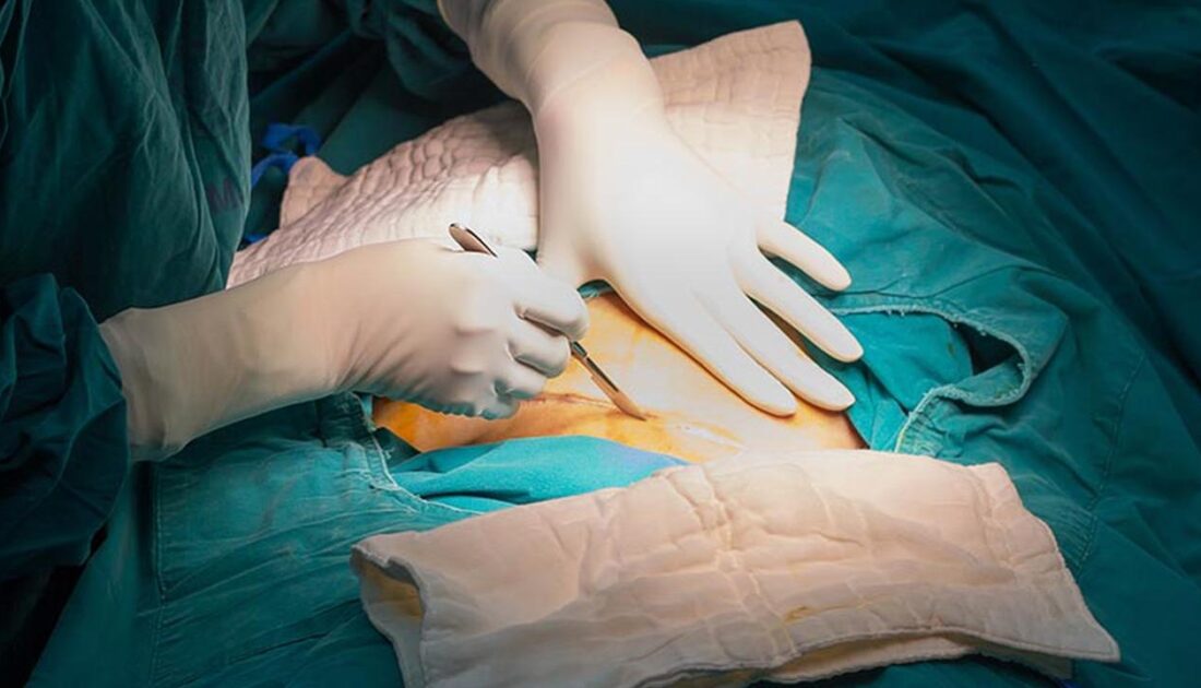 Doğum sırasında bebeğin başını koparan doktora dava