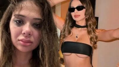 Merve Taşkın sevgilisinden şiddet gördü!