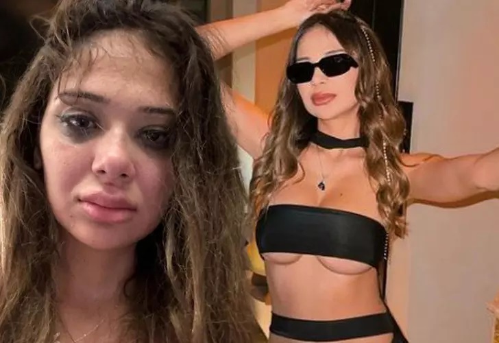 Merve Taşkın sevgilisinden şiddet gördü!
