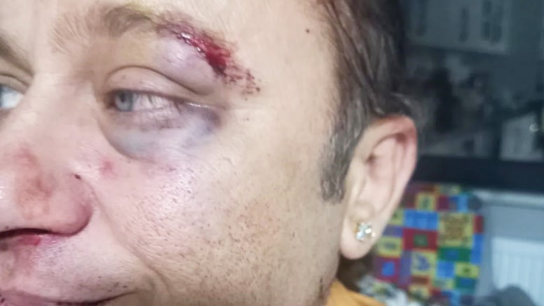 ‘Felaket tellalı’ Onur Akay saldırıya uğradı