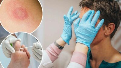 Cinsel yolla bulaşan genital saçkıran vakası görüldü