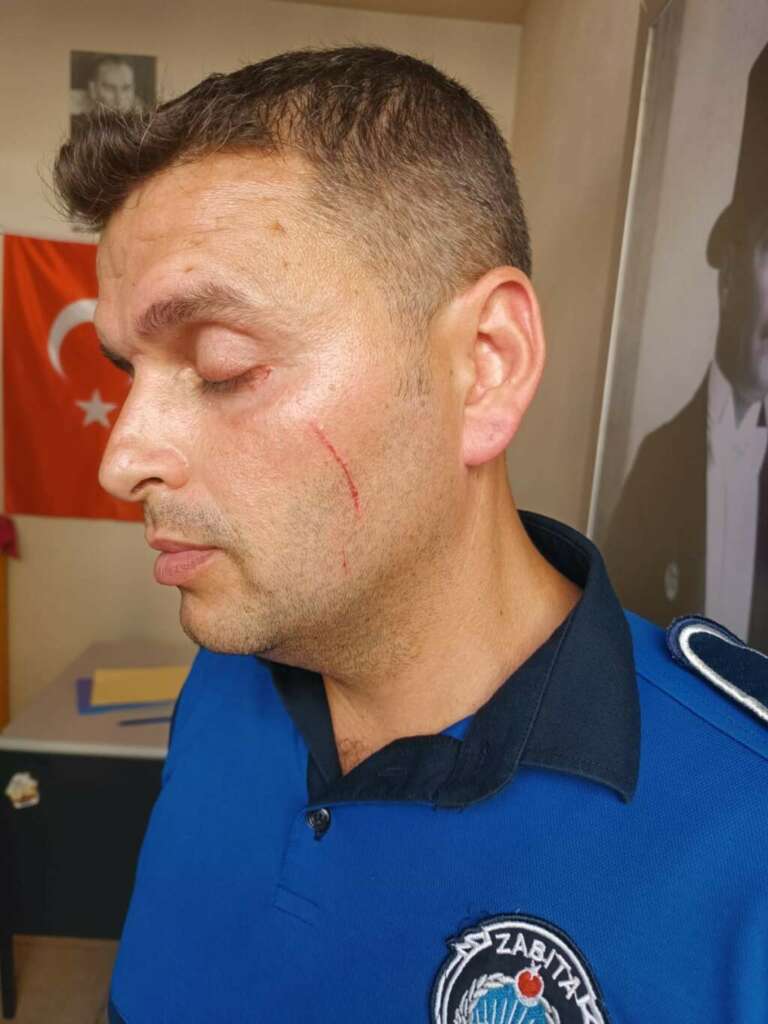 Pişkin dilenci zabıtayı yaraladı