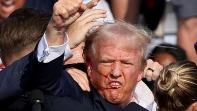 Trump saldırı sonrası ilk röportajını verdi: “Ölmüş olmam gerekiyordu”