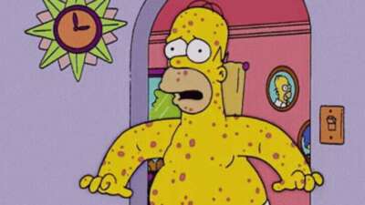 The Simpsons (Simpsonlar) yine iş başında! Maymun çiçeği virüsünü de mi bildiler?