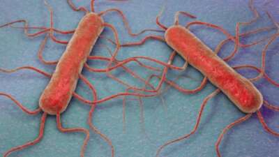 ABD’de listeria salgını: 9 ölü