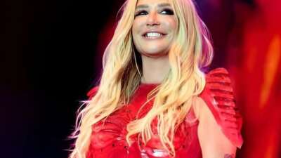 Ünlü şarkıcı Kesha’yı görenler şoke oldu