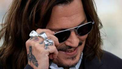 Johnny Depp dişlerini yaptırdı