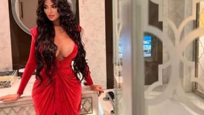 Kim Kardashian’a benzemek için 1 milyon dolar harcamıştı!