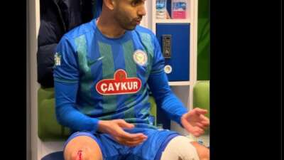 Çaykur Rizespor, Rachid Ghezzal’ın darbe alan ayağının fotoğrafını paylaştı