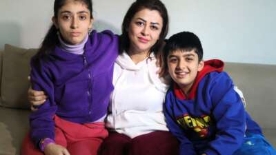 Zihinsel engelli kardeşler milyonda bir görülen hastalığa yakalandı