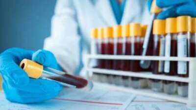 Uzmanlardan test yapın uyarısı! Bu 6 ilde yaşayan çiftler dikkat!