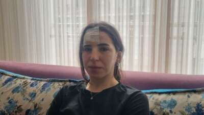 Başıboş köpekler bir kadına saldırdı