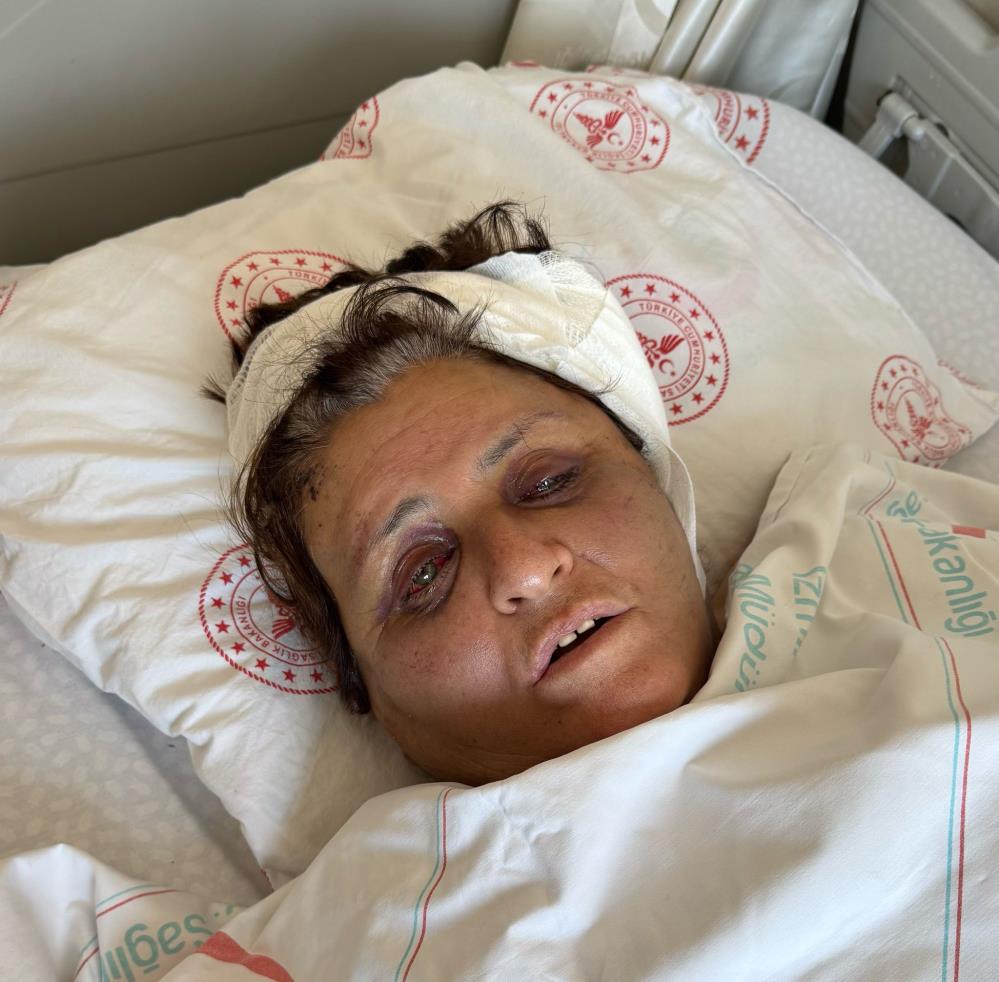 Yufka yüzünden gelini tarafından tuğlayla dövüldü