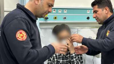 Elbise giyerken gözünü fermuara sıkıştırdı