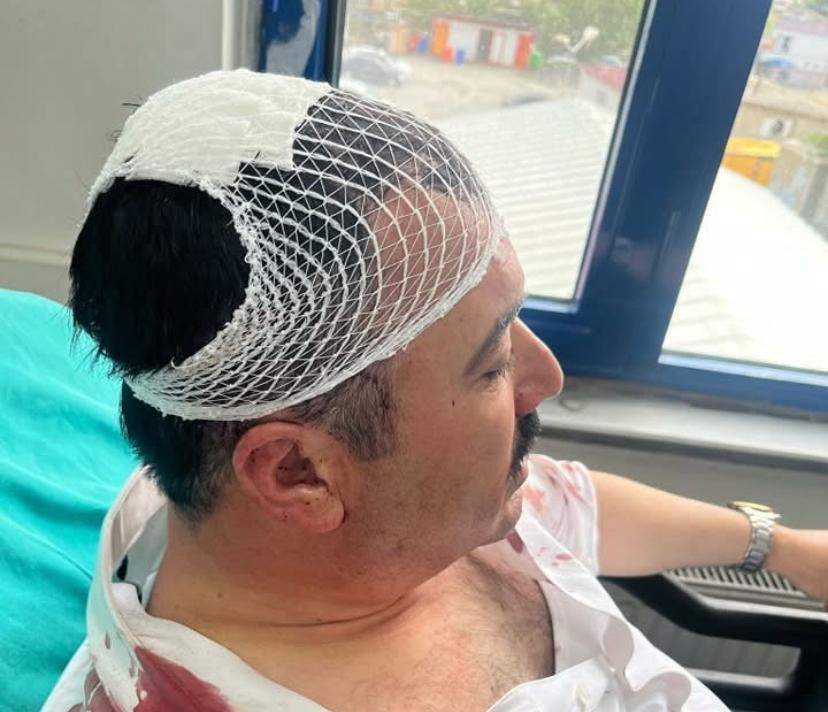 Yeniden Refah Partili Başkan Yardımcısı, belediye başkan yardımcısının kafasına şekerlikle vurdu Yeniden Refah Partili Başkan Yardımcısı, belediye başkan yardımcısının kafasına şekerlikle vurdu
