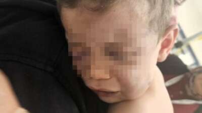 Vahşeti yaşayan 2 yaşındaki bebek hastanelik oldu