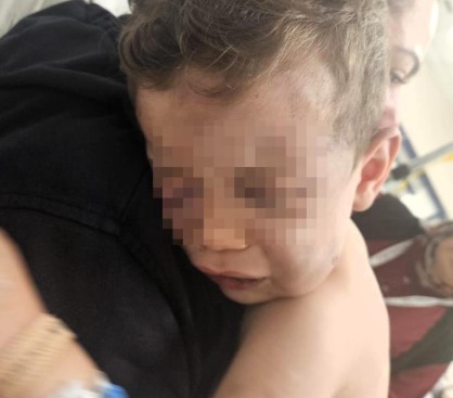 Vahşeti yaşayan 2 yaşındaki bebek hastanelik oldu