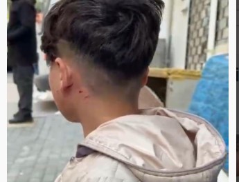 Bursa’da camı tıklattığı için çocuğu darp etti