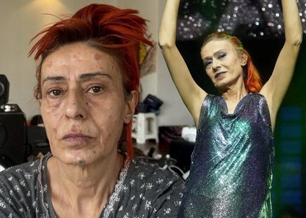Yıldız Tilbe saçlarını kısacık kestirdi