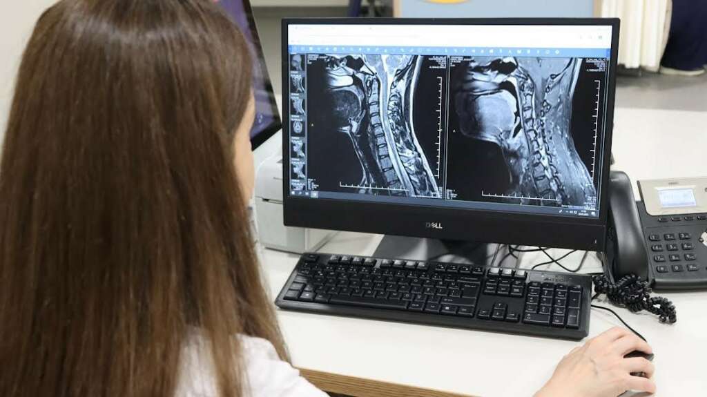 MS hastalığında erken teşhis hayat kalitesini arttırıyor