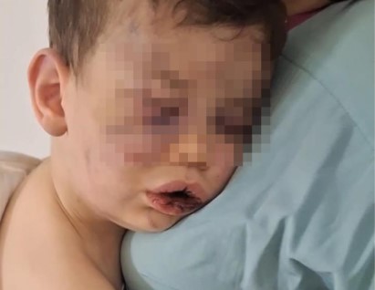 Darp sonucu hastanelik olan bebek devlet korumasına alınacak Darp sonucu hastanelik olan bebek devlet korumasına alınacak