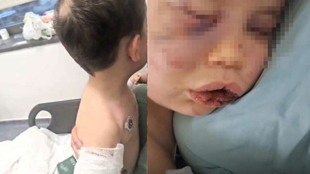 Aile ve Sosyal Hizmetler Bakanlığı: “Tedavi sürecinin ardından çocuğumuz devlet korumasına alınacaktır” Aile ve Sosyal Hizmetler Bakanlığı: “Tedavi sürecinin ardından çocuğumuz devlet korumasına alınacaktır”