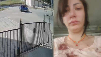 Bursa’da sokak köpeği dehşet saçtı!