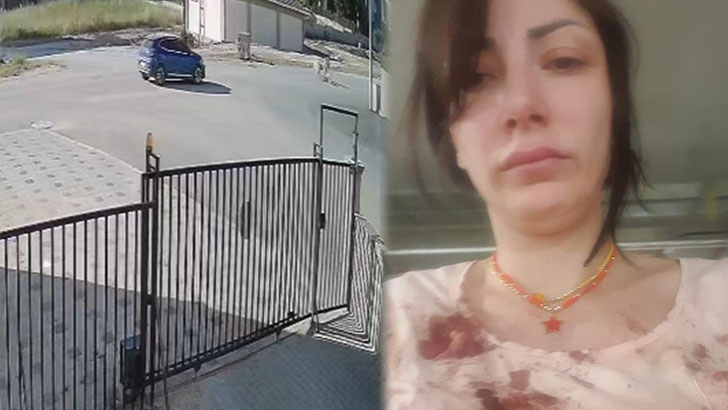 Bursa’da sokak köpeği dehşet saçtı!