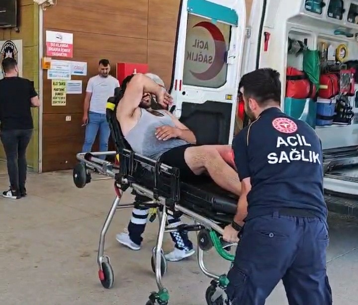 Bursa’da radyatörden fışkıran kaynar su oto tamircisini yaraladı